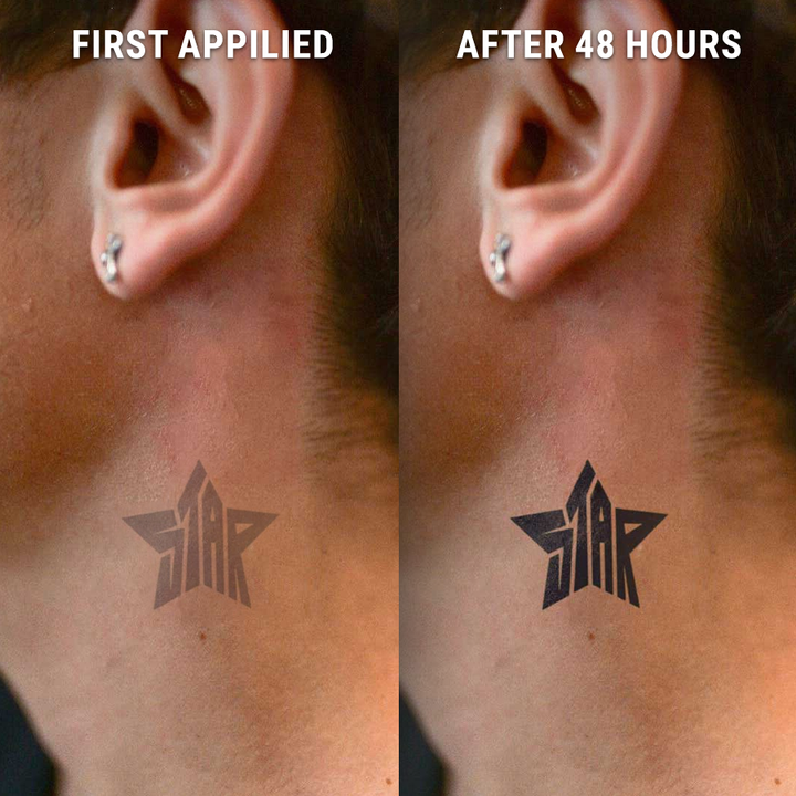 Before-After-Boldstar