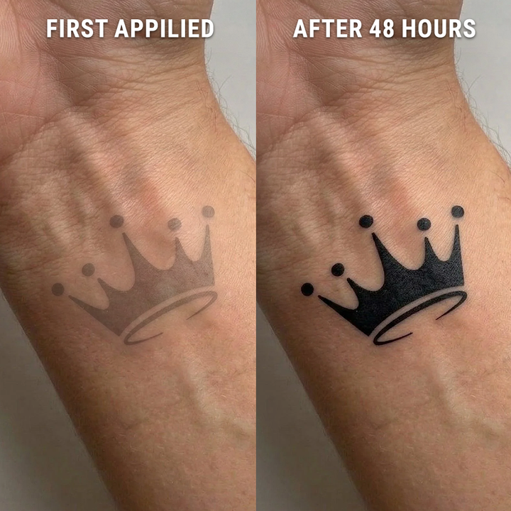 Before-After-Crown