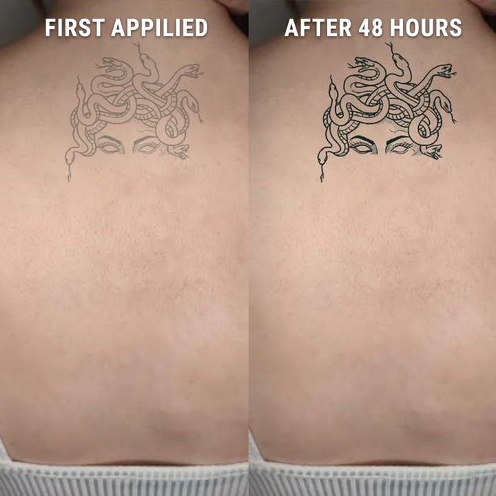 Before-After-Medusa