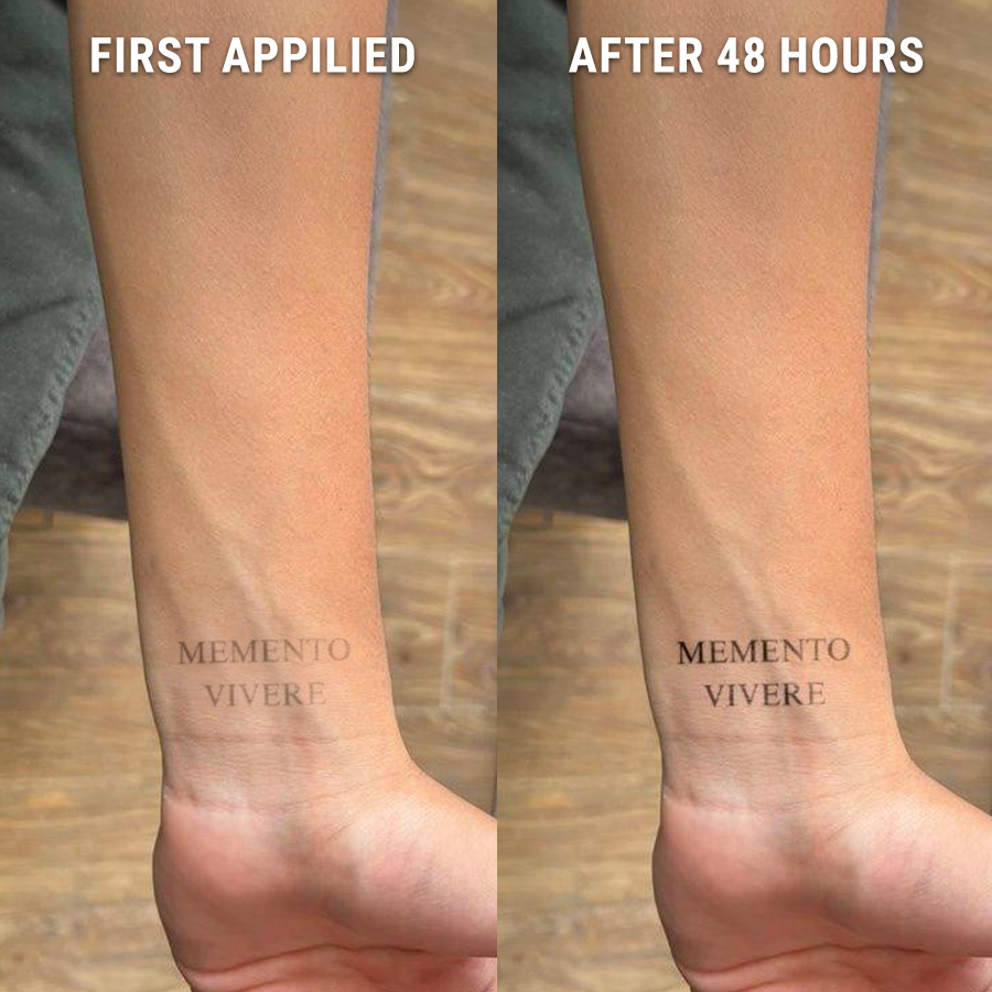 Before-After-Memento-Vivere