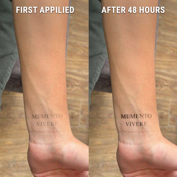 Before-After-Memento-Vivere