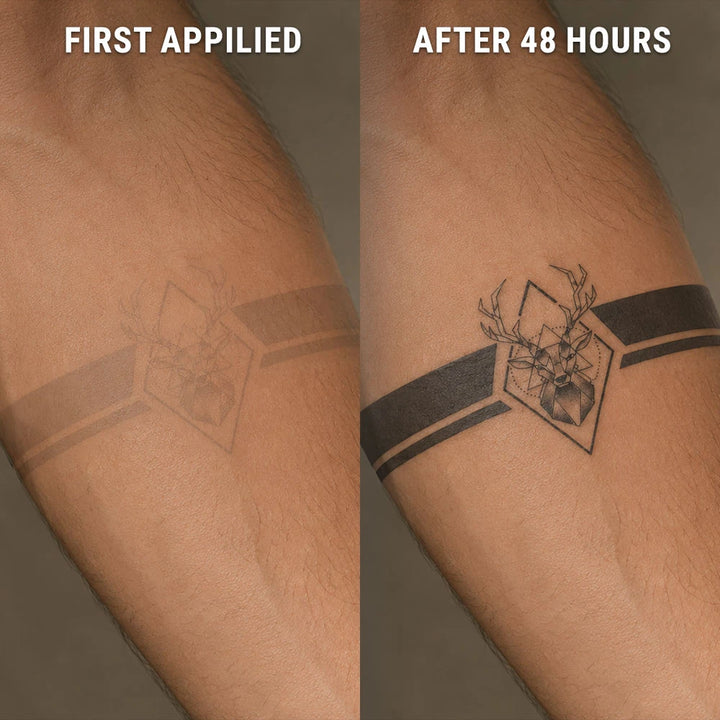 Elysian-Armband-after-before