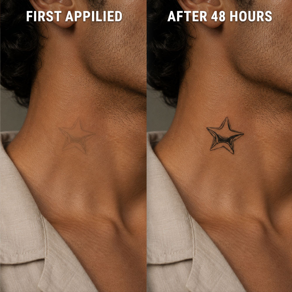 star-after-before